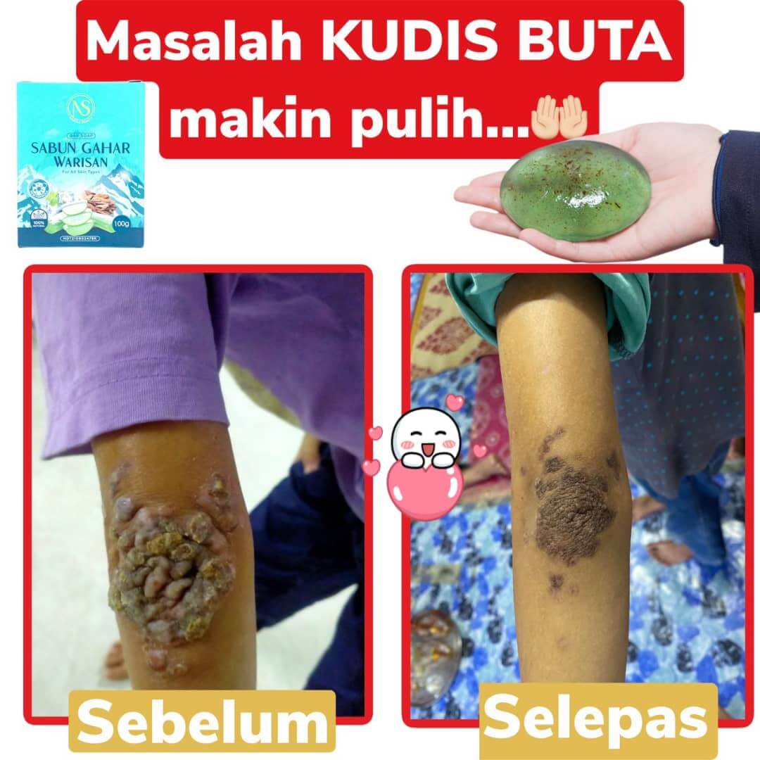 WhatsApp-Image-2022-12-12-at-12.54.09-PM-1.jpeg